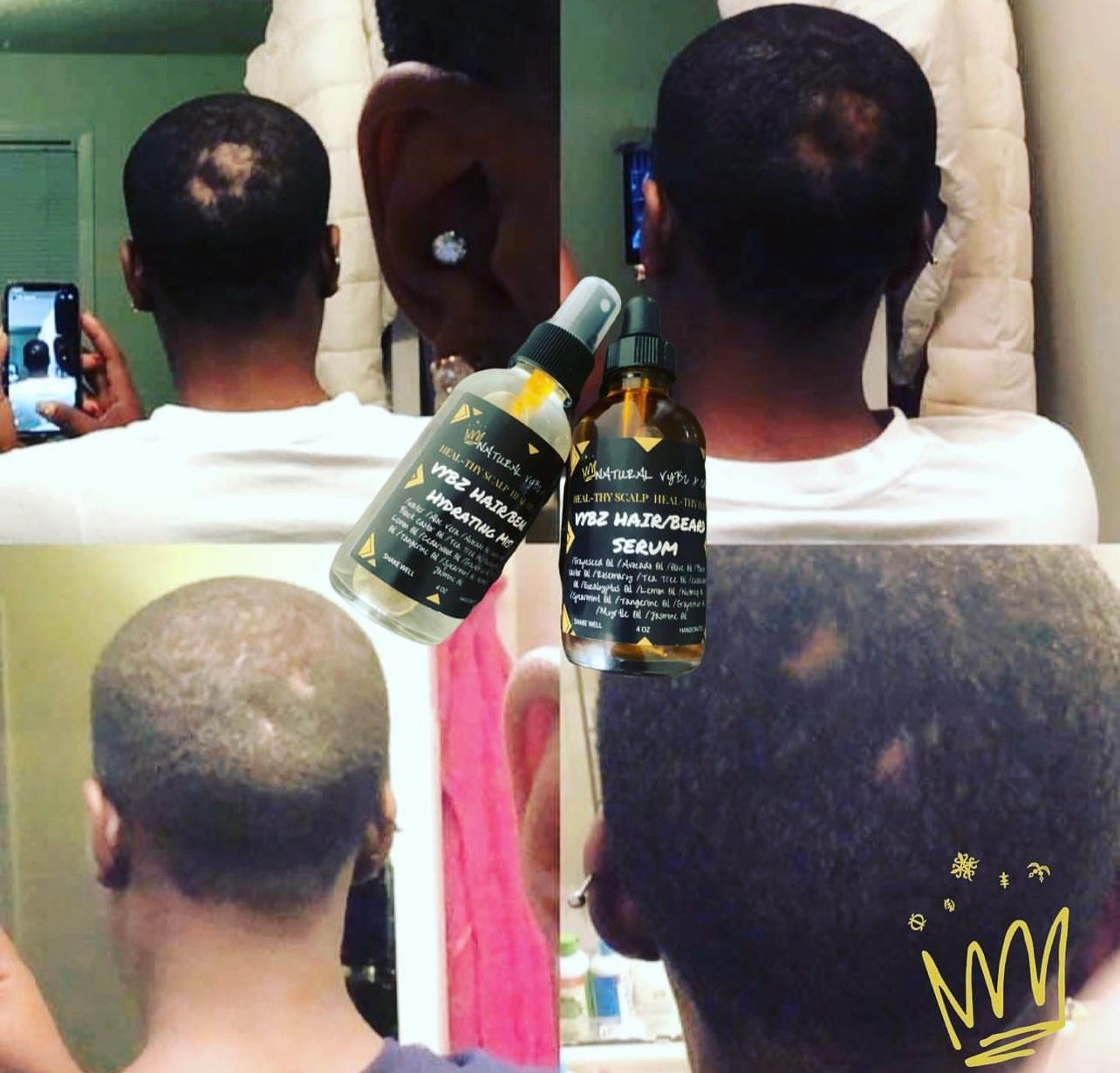 Vybz Hair/Beard Hydration Growth Kit | Awaken Your Roots & Hydrate Your Crown