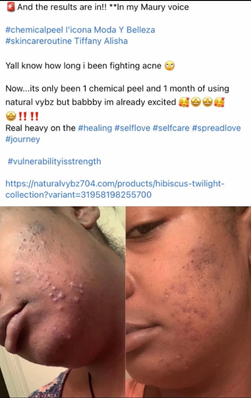 Vybz 3 Step Hibiscus Flawless Skincare Routine | Natural Skincare for Radiant Skin